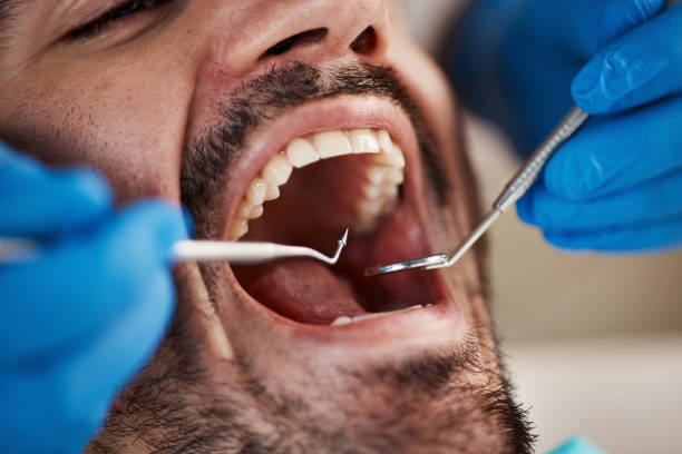 Best Emergency Treatment for Toothache in Willard, UT